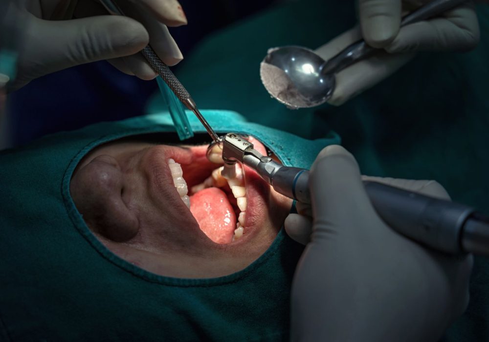 Closeup Dentist and assistant operating for checking and teeth cleaning at dental clinic, Tooth care concept.